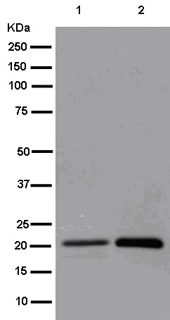 Western blot - Anti-RNF185 + RNF5/NG2 antibody [EPR14070-94] - BSA and Azide free (AB250564)