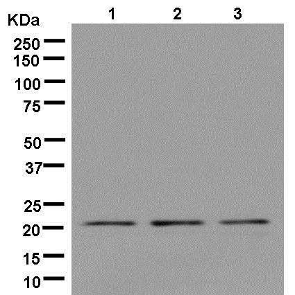 Western blot - Anti-RNF185+RNF5/NG2 antibody [EPR14070] - BSA and Azide free (AB250443), expandable thumbnail