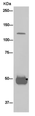 Immunoprecipitation - Anti-RNF20 antibody [EPR13562(B)] (AB181104)