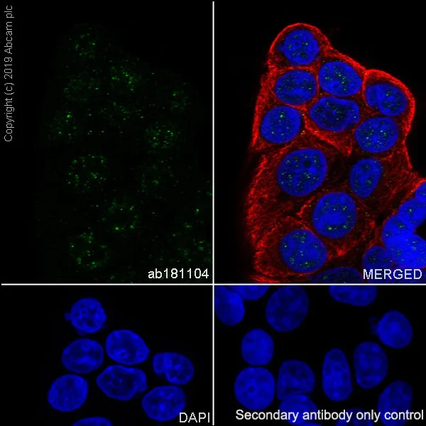 Immunocytochemistry/ Immunofluorescence - Anti-RNF20 antibody [EPR13562(B)] - BSA and Azide free (AB250351)