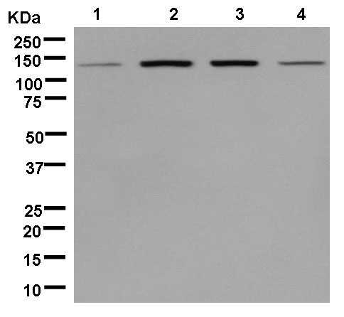 Western blot - Anti-RNF20 antibody [EPR13562(B)] - BSA and Azide free (AB250351), expandable thumbnail