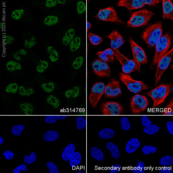 Immunocytochemistry/ Immunofluorescence - Anti-RNF20 antibody [RM1054] (AB314769), expandable thumbnail