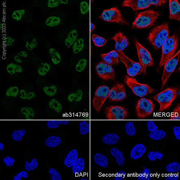 Immunocytochemistry/ Immunofluorescence - Anti-RNF20 antibody [RM1054] - BSA and Azide free (AB314770)