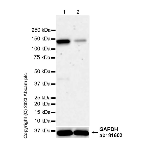 Western blot - Anti-RNF20 antibody [RM1054] - BSA and Azide free (AB314770)
