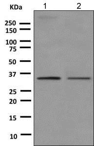 Western blot - Anti-RNF212 antibody [EPR8796] - BSA and Azide free (AB248993)
