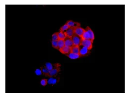 Immunocytochemistry/ Immunofluorescence - Anti-RNF214 antibody [EPR12940] - BSA and Azide free (AB250252)