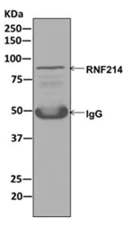 Immunoprecipitation - Anti-RNF214 antibody [EPR12940] - BSA and Azide free (AB250252)