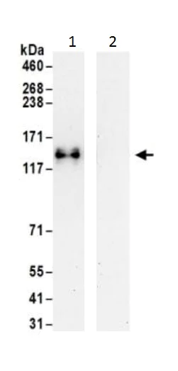 Immunoprecipitation - Anti-RNF216 antibody (AB226215)