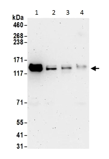 Western blot - Anti-RNF216 antibody (AB226215)