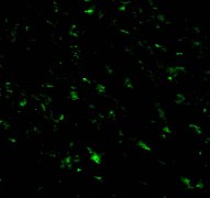 Immunocytochemistry/ Immunofluorescence - Anti-RNF216 antibody (AB25961)