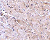 Immunohistochemistry (Formalin/PFA-fixed paraffin-embedded sections) - Anti-RNF216 antibody (AB25961)