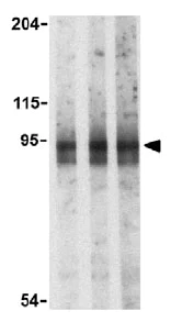 Western blot - Anti-RNF216 antibody (AB25961)