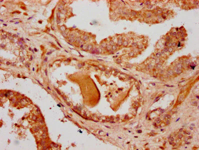 Immunohistochemistry (Formalin/PFA-fixed paraffin-embedded sections) - Anti-RNF220 antibody (AB236992)