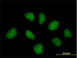 Immunocytochemistry/ Immunofluorescence - Anti-RNF220 antibody (AB69357)