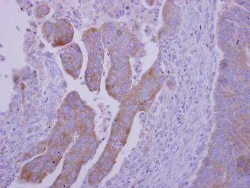 Immunohistochemistry (Formalin/PFA-fixed paraffin-embedded sections) - Anti-RNF23 antibody (AB227542)