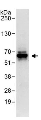Immunoprecipitation - Anti-RNF25 antibody (AB140514)