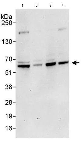 Western blot - Anti-RNF25 antibody (AB140514)