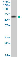 Western blot - Anti-RNF25 antibody (AB89281)