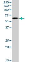 Western blot - Anti-RNF25 antibody (AB89281)
