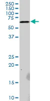 Western blot - Anti-RNF25 antibody (AB89281)