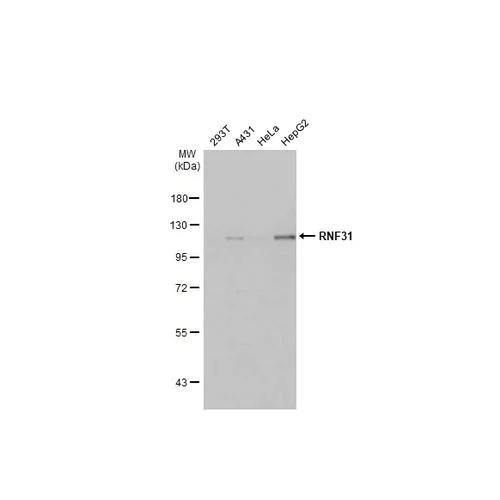 Western blot - Anti-RNF31 antibody [HL2295] (AB317191)