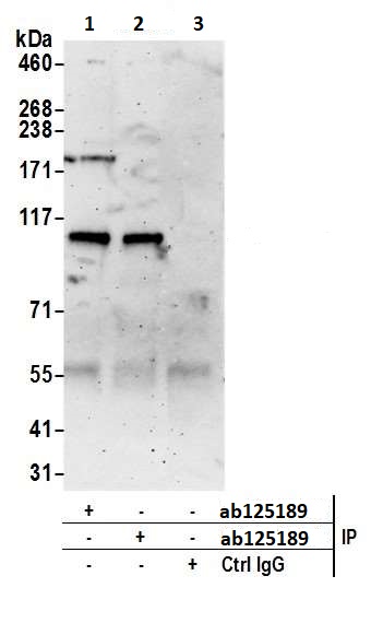 Immunoprecipitation - Anti-RNF31/HOIP antibody (AB125189), expandable thumbnail
