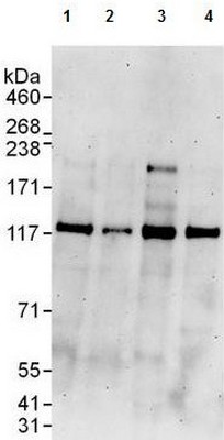 Western blot - Anti-RNF31/HOIP antibody (AB125189), expandable thumbnail