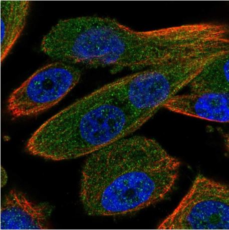 Immunocytochemistry/ Immunofluorescence - Anti-RNF31/HOIP antibody (AB187976), expandable thumbnail