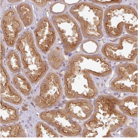 Immunohistochemistry (Formalin/PFA-fixed paraffin-embedded sections) - Anti-RNF31/HOIP antibody (AB187976), expandable thumbnail