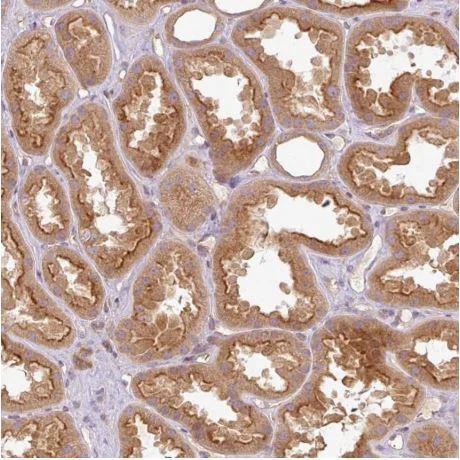 Immunohistochemistry (Formalin/PFA-fixed paraffin-embedded sections) - Anti-RNF31/HOIP antibody (AB187976)
