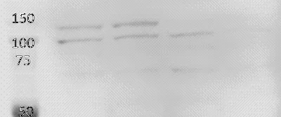 Western blot - Anti-RNF31/HOIP antibody (AB46322)