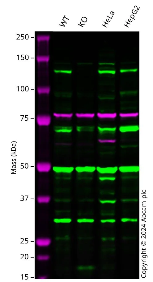 Western blot - Anti-RNF31/HOIP antibody (AB46322)