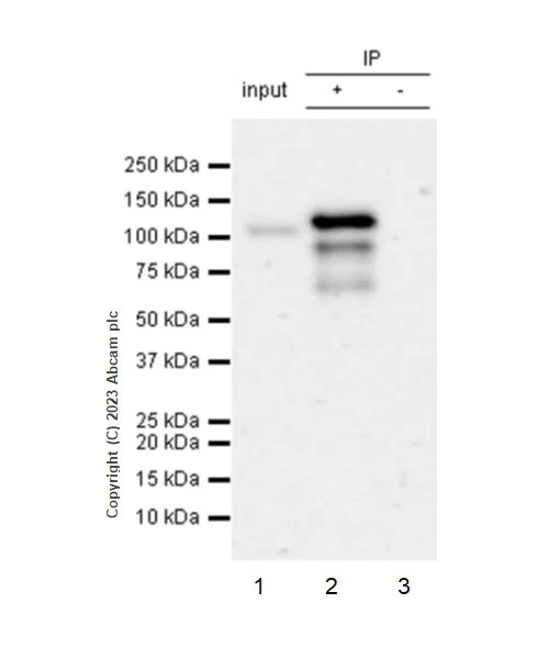 Immunoprecipitation - Anti-RNF31/HOIP antibody [EPR27947-265] - BSA and Azide free (AB315163)
