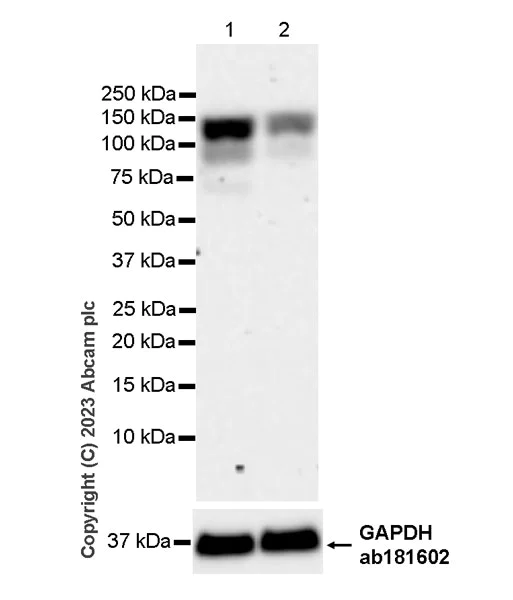 Western blot - Anti-RNF31/HOIP antibody [EPR27947-265] - BSA and Azide free (AB315163)