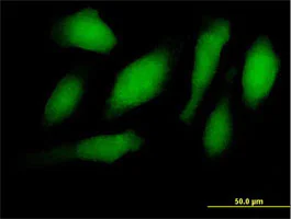 Immunocytochemistry/ Immunofluorescence - Anti-RNF34 antibody (AB169047)