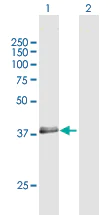 Western blot - Anti-RNF34 antibody (AB169047)