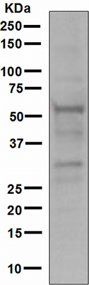 Western blot - Anti-RNF36 antibody [EPR4755] (AB111943)