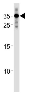 Western blot - Anti-RNF4 antibody (AB230438)