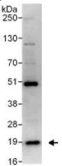 Immunoprecipitation - Anti-RNF5/NG2 antibody (AB128200)