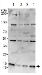 Western blot - Anti-RNF5/NG2 antibody (AB128200)