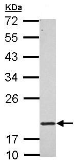 Western blot - Anti-RNF5/NG2 antibody (AB154959)