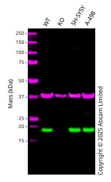 Western blot - Anti-RNF5/NG2 antibody [EPR27133-30] (AB308066), expandable thumbnail