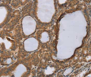 Immunohistochemistry (Formalin/PFA-fixed paraffin-embedded sections) - Anti-RNF5/NG2 antibody - N-terminal (AB200389)