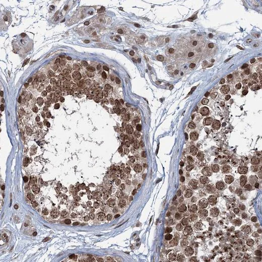 Immunohistochemistry (Formalin/PFA-fixed paraffin-embedded sections) - Anti-RNF6 antibody (AB204506)