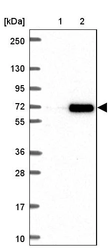 Western blot - Anti-RNF6 antibody (AB204506)