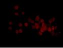 Immunocytochemistry/ Immunofluorescence - Anti-RNF7 antibody [EPR12001] (AB181986), expandable thumbnail