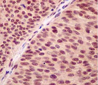 Immunohistochemistry (Formalin/PFA-fixed paraffin-embedded sections) - Anti-RNF7 antibody [EPR12001] (AB181986), expandable thumbnail
