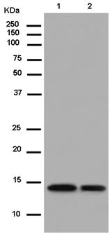Western blot - Anti-RNF7 antibody [EPR12001] (AB181986)