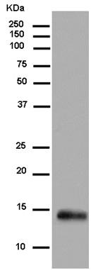 Western blot - Anti-RNF7 antibody [EPR12001] (AB181986), expandable thumbnail