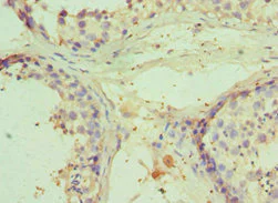 Immunohistochemistry (Formalin/PFA-fixed paraffin-embedded sections) - Anti-RNF8 antibody (AB234977)